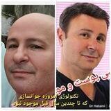 دکتر حاتمی - کلینیک تخصصی پوست و جوانسازی