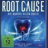 RootCause