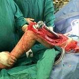 عمليات جراحية 🔪