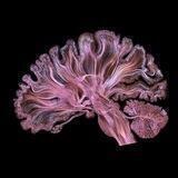 neuroнчик