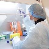 Олмалиқ шаҳар Санитария эпидемиологик осойишталиги ва жамоат саломатлиги бўлими расмий канали
