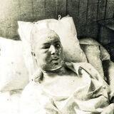 Cancer, the forbidden cures