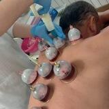 Хиджама ва зулук ЗАРАФШОН 99-356-69-89