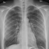 chest x-ray (free)