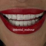 Dental_mahour