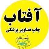 آفتاب - چاپ تصاویر پزشکی