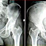 Forensic Anthropology / Tranvestigation