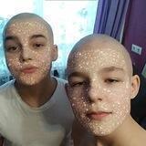 bald&balls