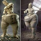 Liposaksiya_Abdominoplastika_Mamoplastika