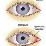 ophthalmology books , courses...