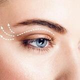 Blefaroplastika_ qovoq olish