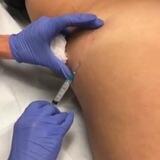 BODY ENHANCEMENT WORLD 💉🍑🌎😱 | HYDROGEL |SCULPTRA | JUVERDEM |