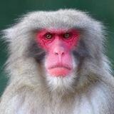 Monkeypox Poxvirus