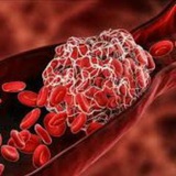 Hematology system