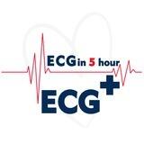 ECG plus