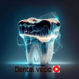 Dental vedio