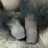 Pentelhos e peles (Solo Brasil)
