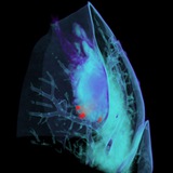 Cancer 3D