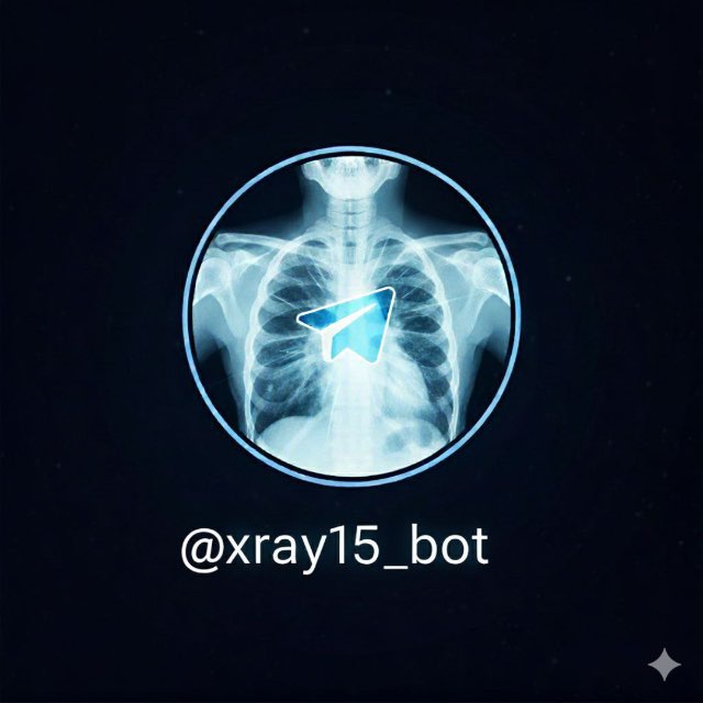 Xray bot