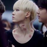 Agust D