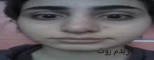 choso